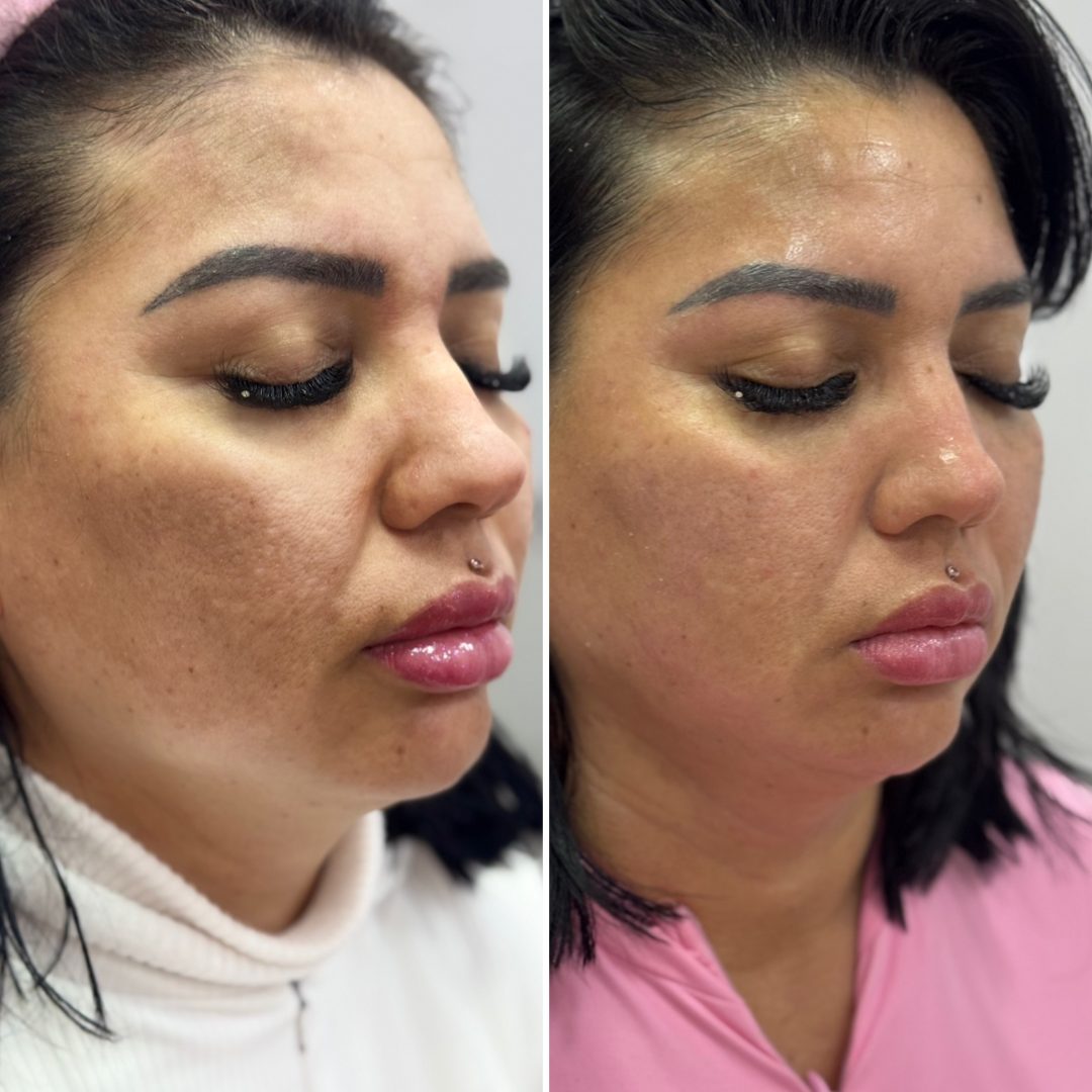 3327AA5F-49EF-4E73-8FA8-638DD5086E38