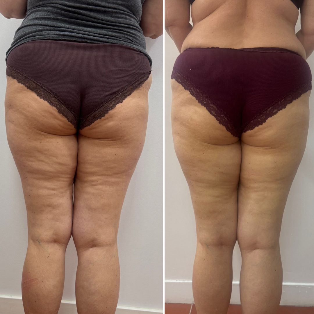 40C35E0F-F72C-41A1-B121-E3CCB796D11A