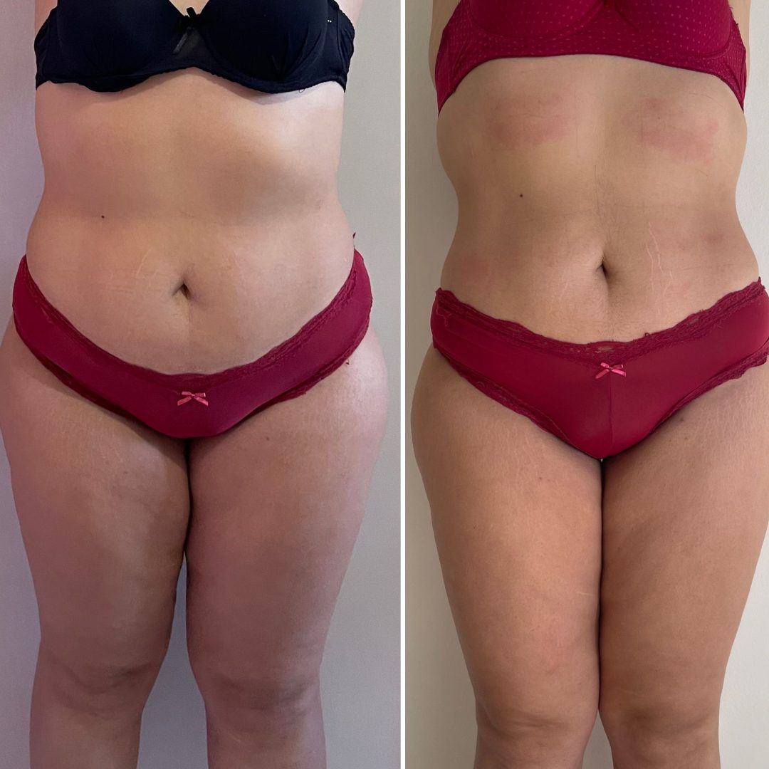 b6d88890-a52d-4273-abcd-01d526cc01ca