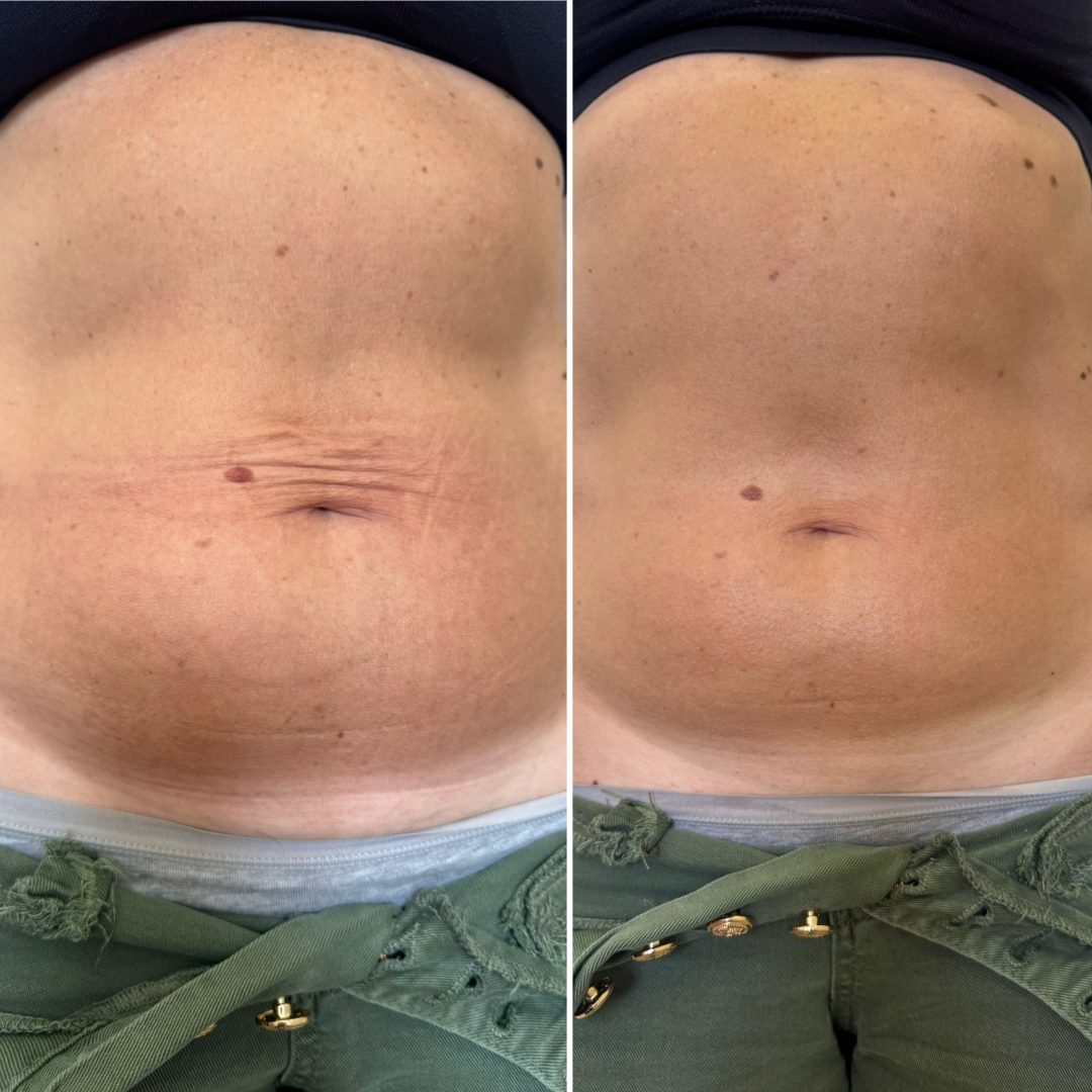 fc558802-11af-4d23-b4d1-e5a8ccbc6908